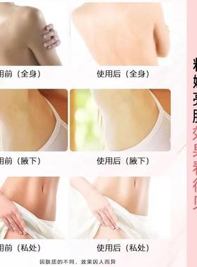 私精粉白嫩去黑色素乳晕屁屁嫩大腿内侧华液私处密保养护理UQM女