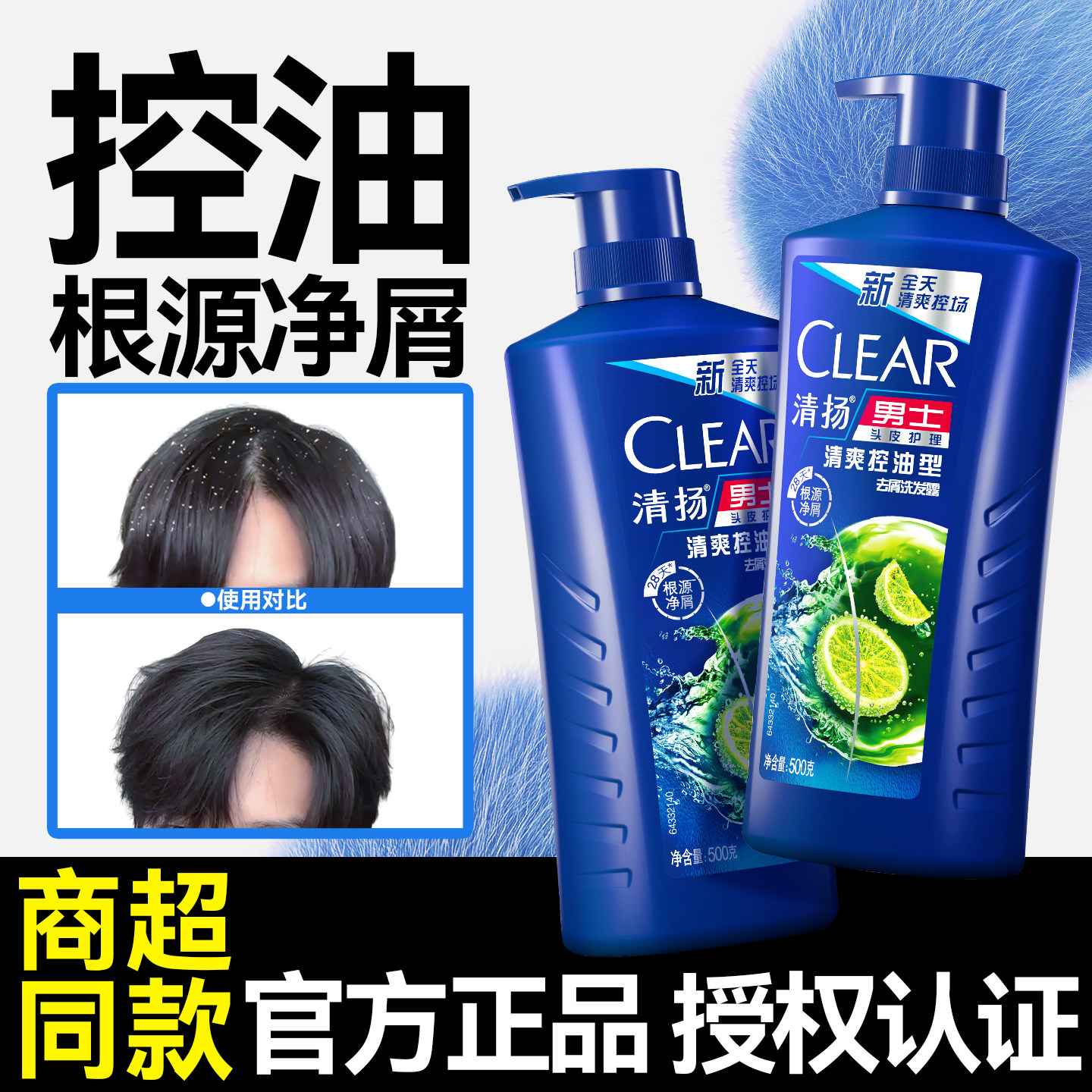 清扬洗发水控油男士蓬松去屑止痒家用正品官方品牌旗舰店防脱头膏