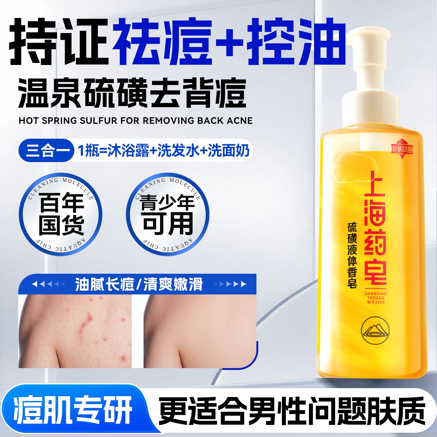 【洗发沐浴洗脸三合一】去背痘