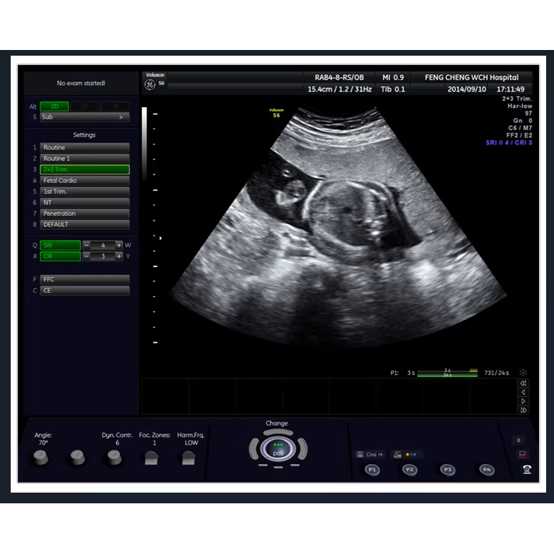 超声工作站超声网络数字超声DICOM软件彩超工作站B超网络版