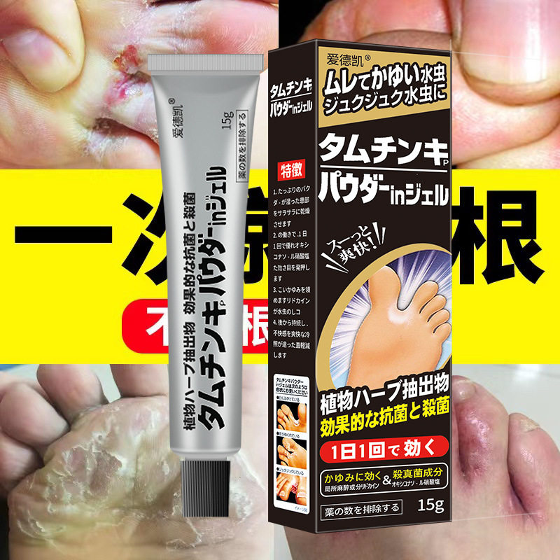 爱德凯去脚藓痒脚藓膏脚廯脚爽脚脱皮烂脚丫去脚湿痒止汗膏