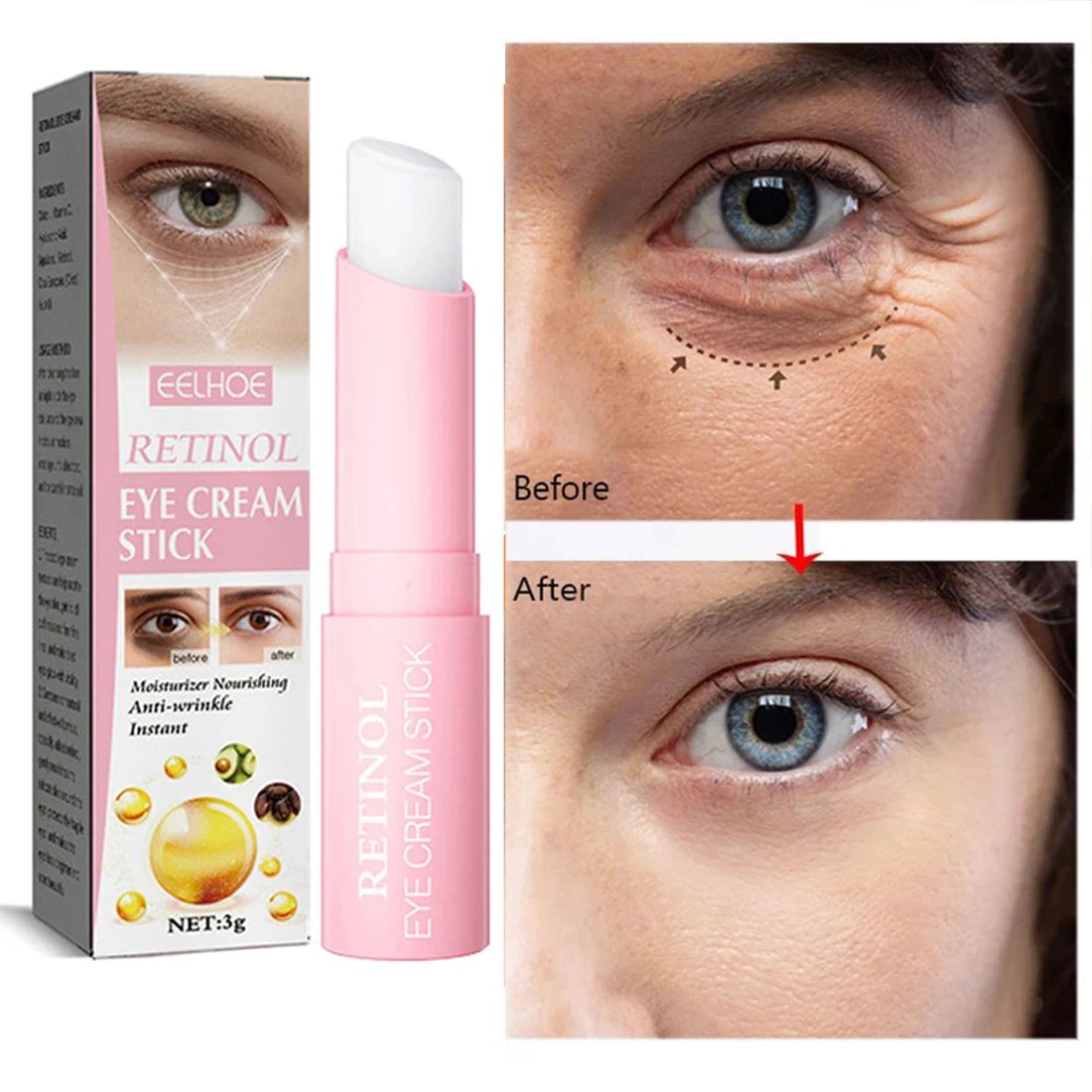 Retinol Eye Cream Instant Removing Eyes Wrinkle Eyes Dark Ci