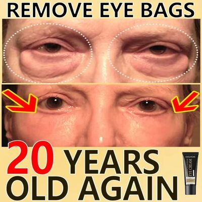Anti Dark Circle Eye Cream Eye Bags Whitening Lightening VC