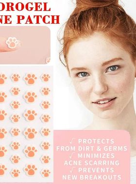 Hydrocolloid Acne Pimple Patch 36 Counts Cute Cat Paws Shape