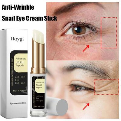 Snail Anti-Wrinkle Eye Cream Stick Dark Circles Eye Bags Red