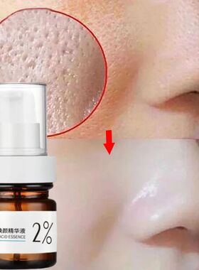 Mildest %2 Salicylic Acid Shrink Pore Face Serum Acne Blackh
