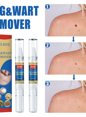 skin clover nevus removal pen body skin tag clover removal