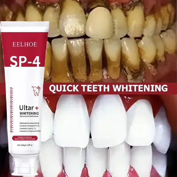 120g Probiotic Caries SP 4 Toothpaste Tooth Whitening Decay