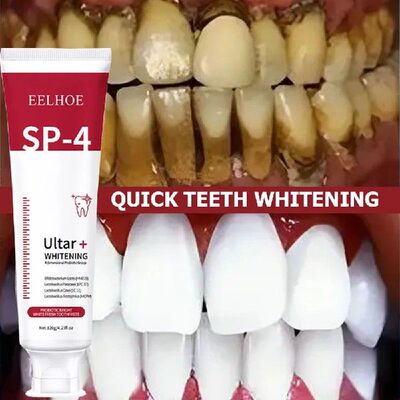 120g Probiotic Caries SP 4 Toothpaste Tooth Whitening Decay
