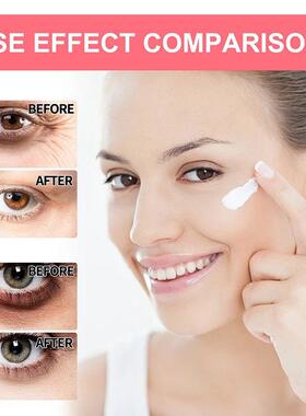 Anti-Wrinkle Eye Cream Retinol Remove Eye Bags Dark Circles