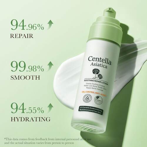 Centella Asiatica Face lotion Anti Acne smoothing积雪草乳液