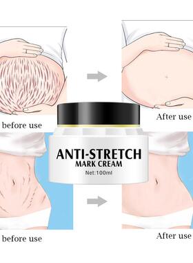 Stretch Mark Repair Cream Maternity Postpartum Fade Removal