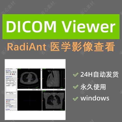 RadiAnt DICOM VIewer医学影像查看软件2023+2021中文版永久激活