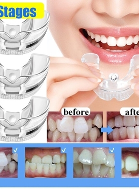 3 Stages Dental Orthodontic Teeth Silicone Braces Appliance