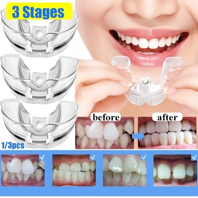 3 Stages Dental Orthodontic Teeth Silicone Braces Appliance