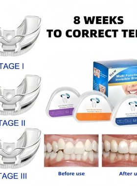 Orthodontic Braces Dental Braces Smile Teeth Alignment Train