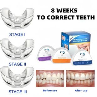 Braces Alignment Dental Teeth Train Smile Orthodontic