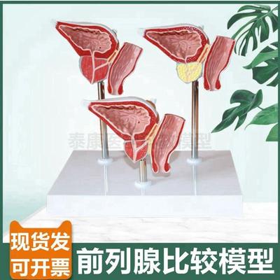 前列腺模型男科生殖泌尿器官膀胱B肾脏解剖内外生殖器睾丸内分泌