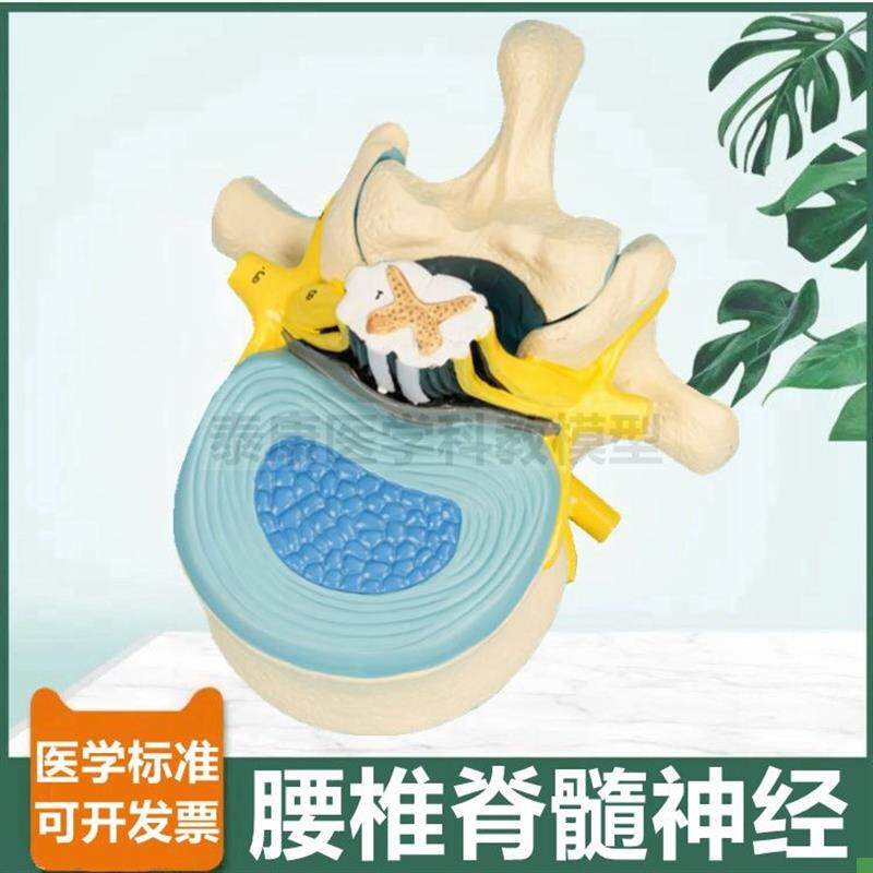 腰椎脊髓解剖模型脊神经根椎管临床麻醉I教学神经节周围椎间盘人