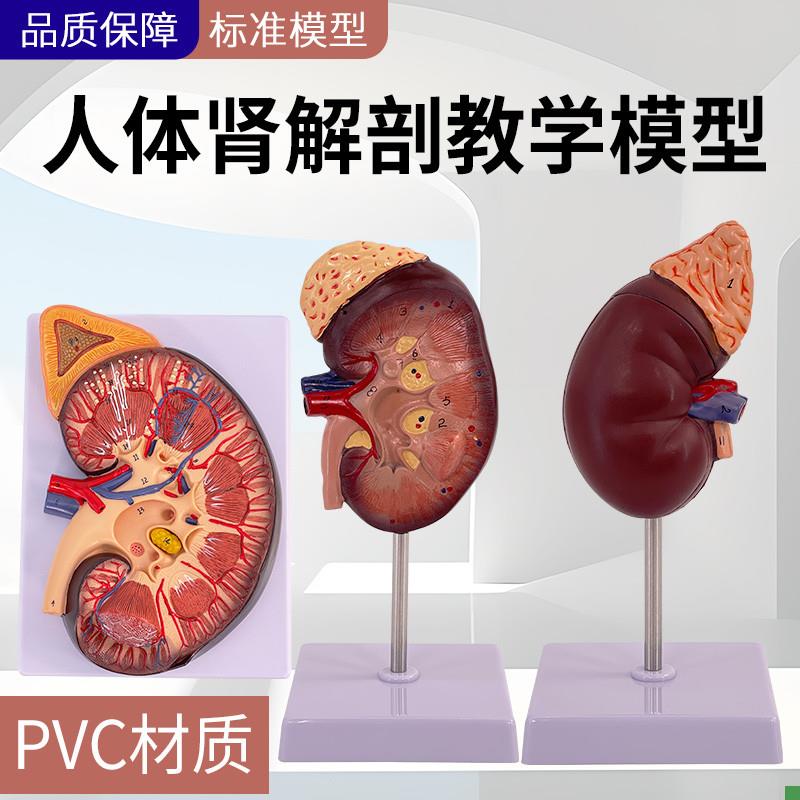 人体肾脏模型肾解剖附肾上腺放大模F型病变肾脏人体内脏器官解剖