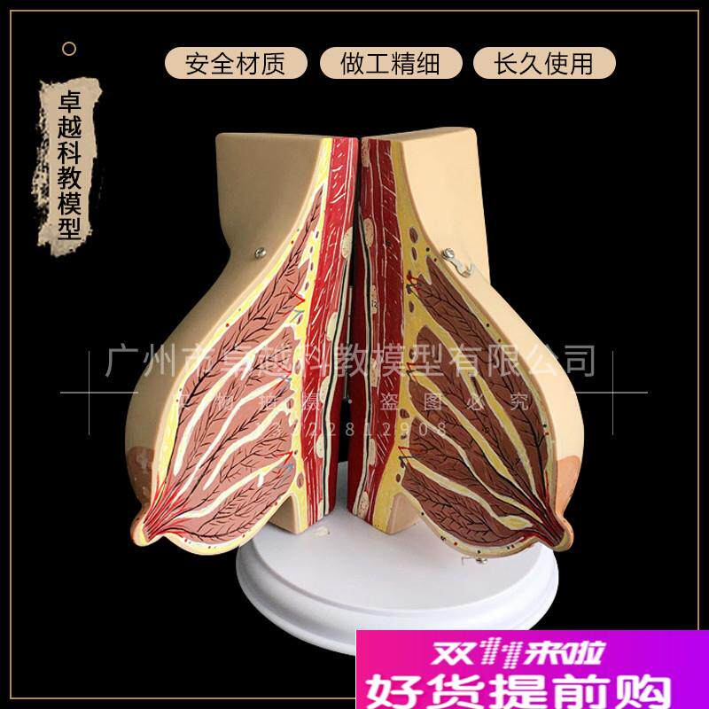 乳房解剖模型哺乳期乳房模型丰胸整形乳房催乳师W培训道具假乳