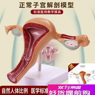 人体子宫附件模型女性医学生殖器卵巢F阴道病理病变结构解剖教学