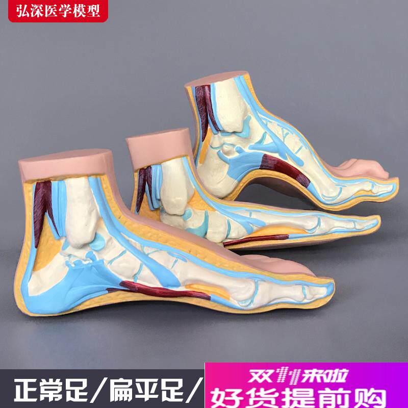 脚模型正常足扁平足弓型足解剖人体D脚部构结构造肌肉血管医学模