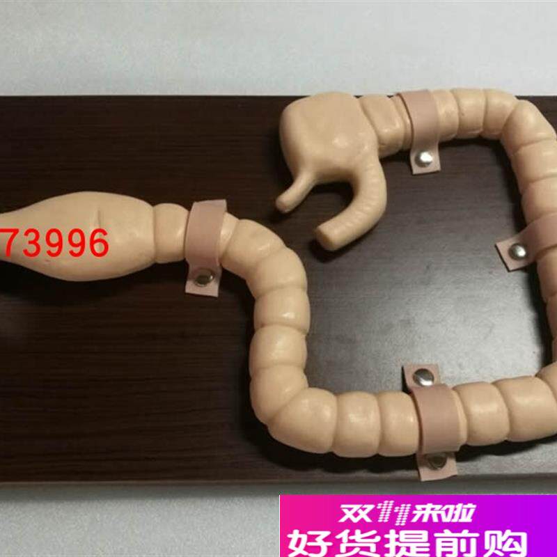 乙状结肠镜检查模w型大肠肠道病变检查模型