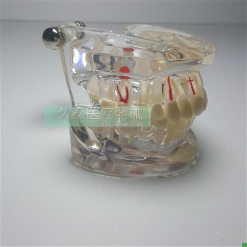 牙齿模型齿科模型牙科模型口C腔模型种植模型教学模型透明