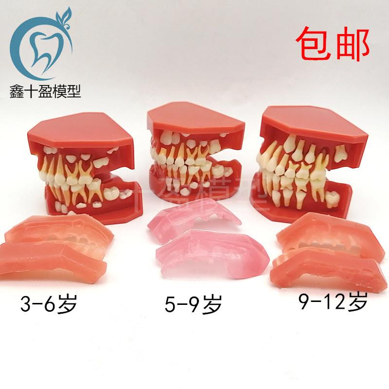 儿童乳牙替换牙齿模型乳恒牙交替3个G阶段口腔5-9髓牙列发育模型