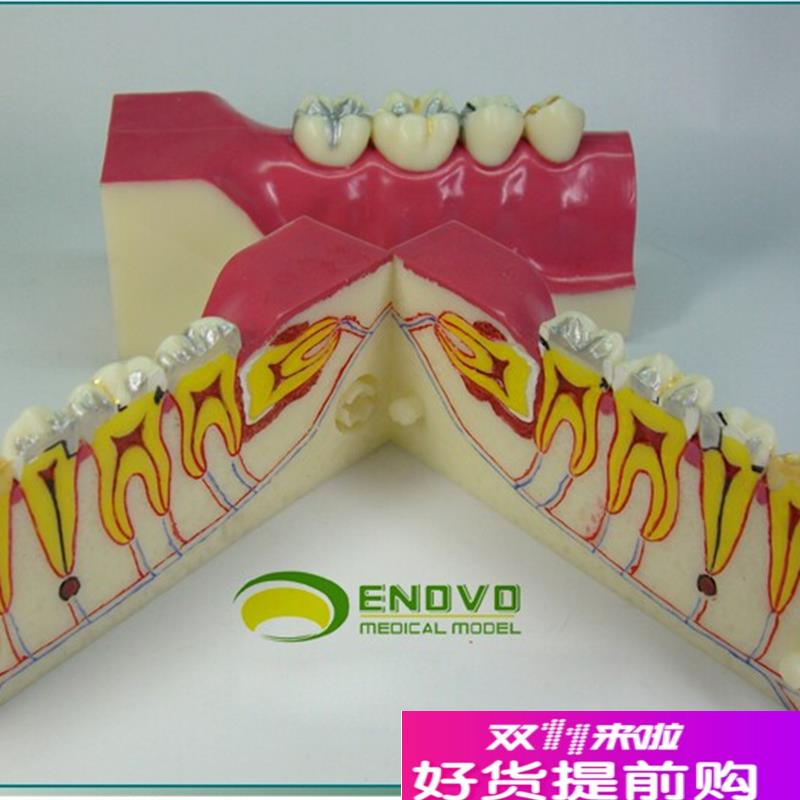 ENOVO颐诺右下后牙组织分解模型牙齿解剖牙列模型口W腔齿科科教学