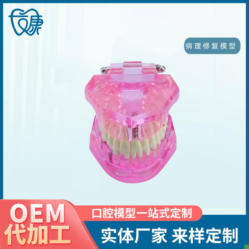 牙齿模型病理修复可拆卸t正畸口腔病理牙模型牙科医患活动沟通