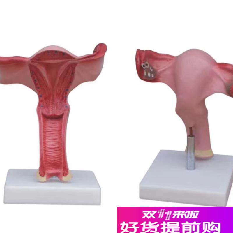 子宫放大模型h阴道生殖器官卵巢输卵管剖面教学训练解剖模具