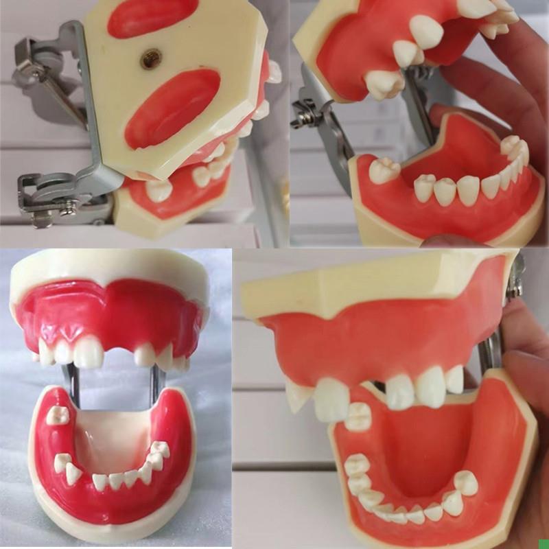 牙科种植模型上下缺失练习切开种植上I颌窦提升术缝合仿骨质牙齿