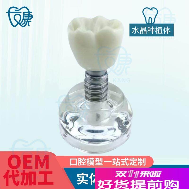 水晶种植体模型透明牙科模型z教学医患沟通模型诊室摆件齿科材料