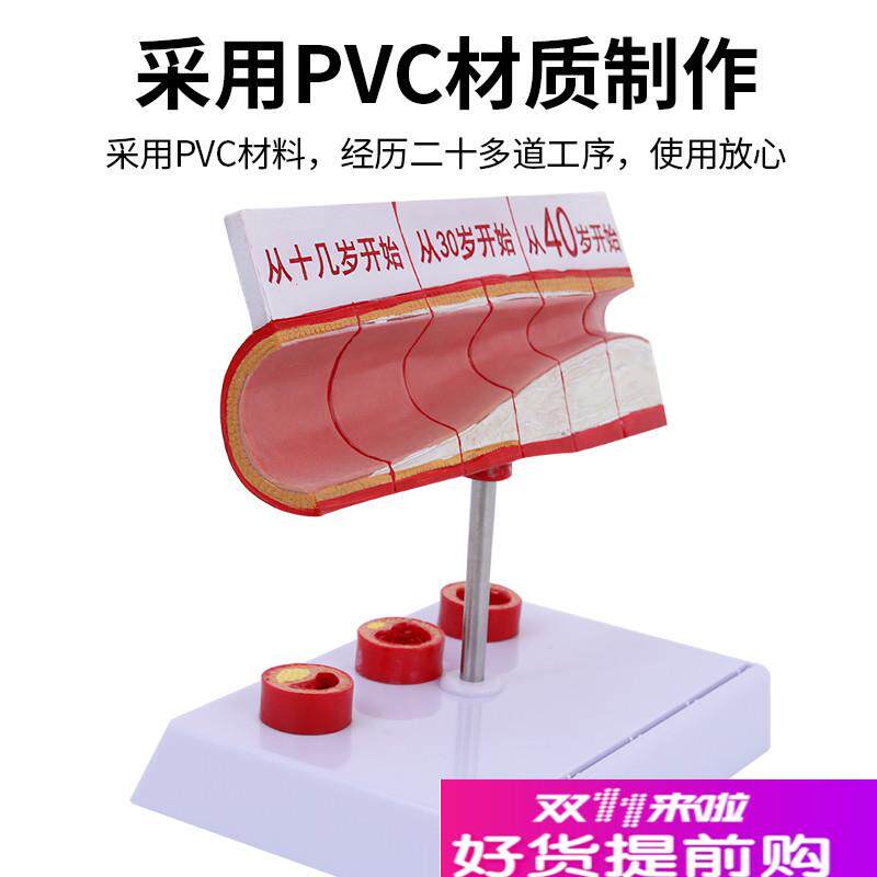 血管人体血管解剖模型各阶段z年龄层血管展示模型大型血管展示