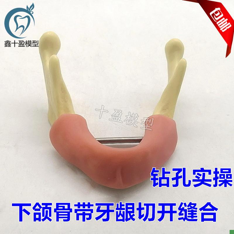 牙科下颌骨种植练习模型仿真牙龈软硅胶钻孔实操练习口Y腔2023