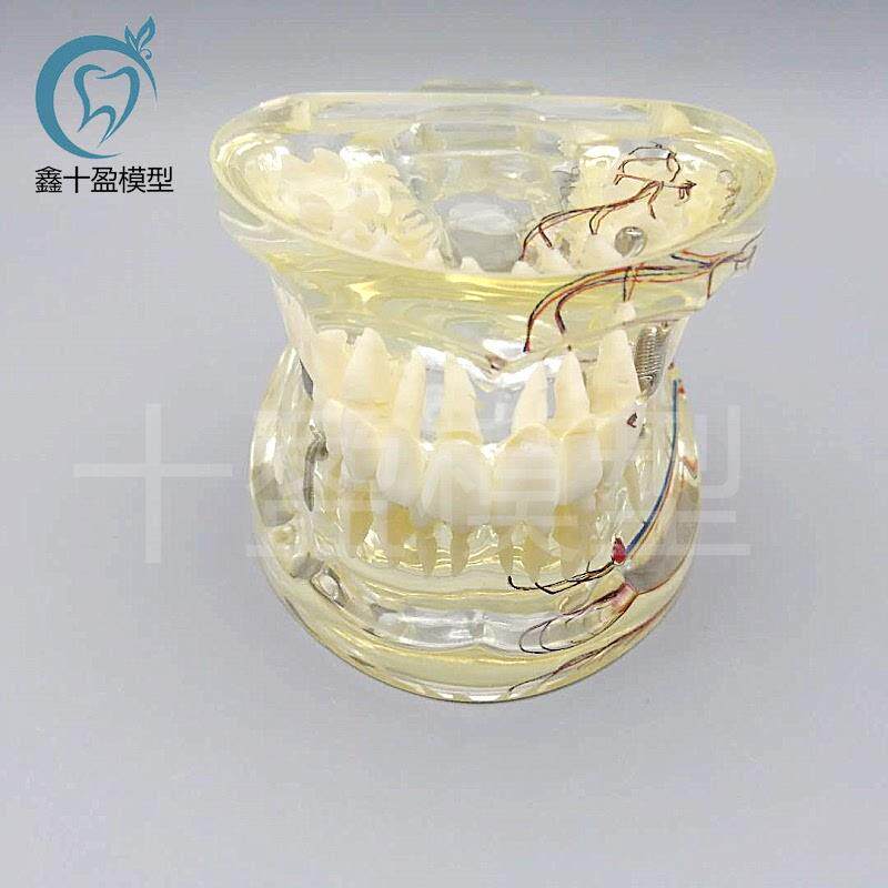 牙科水晶牙齿病理模型M4019-2成人H透明病理牙模型带牙神经和嵌体