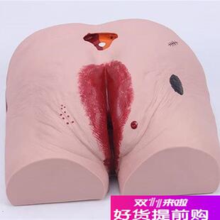 老年人褥疮(压疮)护理模型褥疮护理模型压疮护理W模型褥疮模型