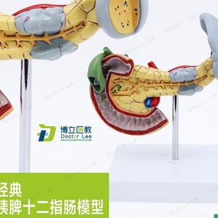 消化胰脏病变胰脾胆o十二指肠模型进口模型人体病变内脏解剖模型