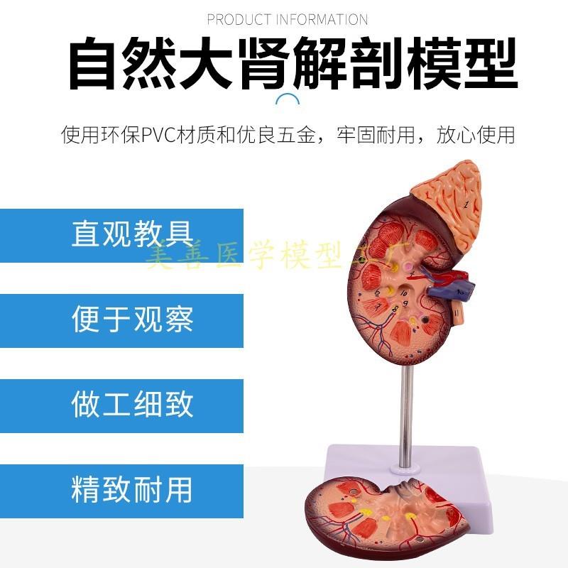 人体肾脏模型肾解剖附肾上腺放A大模型病变肾脏内脏器官解剖3倍