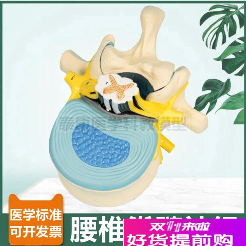 腰椎脊髓解剖模型脊神经根椎管临床麻醉教M学神经节周围椎间盘人