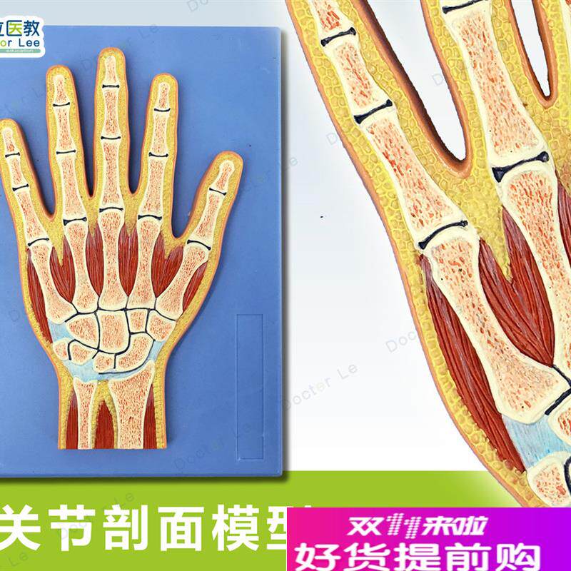 人体断层c扫描手关节切面浮雕手关节断层解剖学模型ct运动解剖