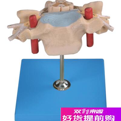 颈椎附脊髓和脊q神经放大模型A18105