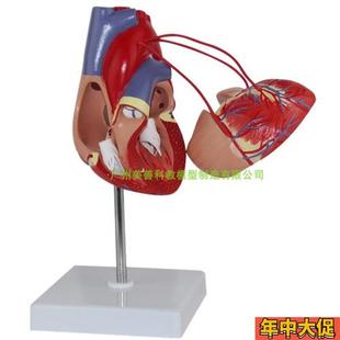 心脏支架心脏搭桥模型开胸手术人体心脏血管结构模型展示教学模型