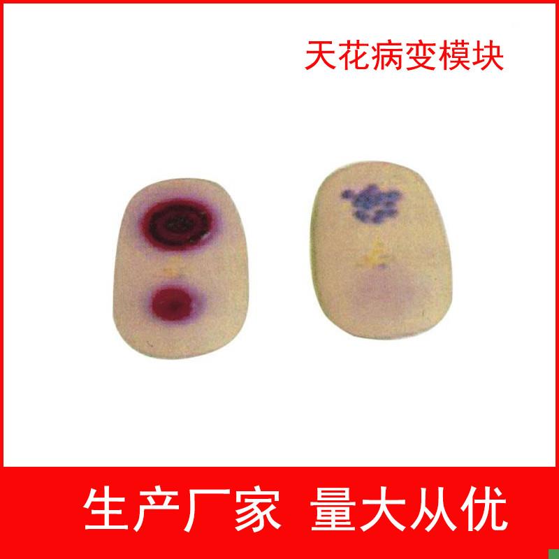 天花病变模块g护理模型天花病毒检查模型医学教学模型护士实习用