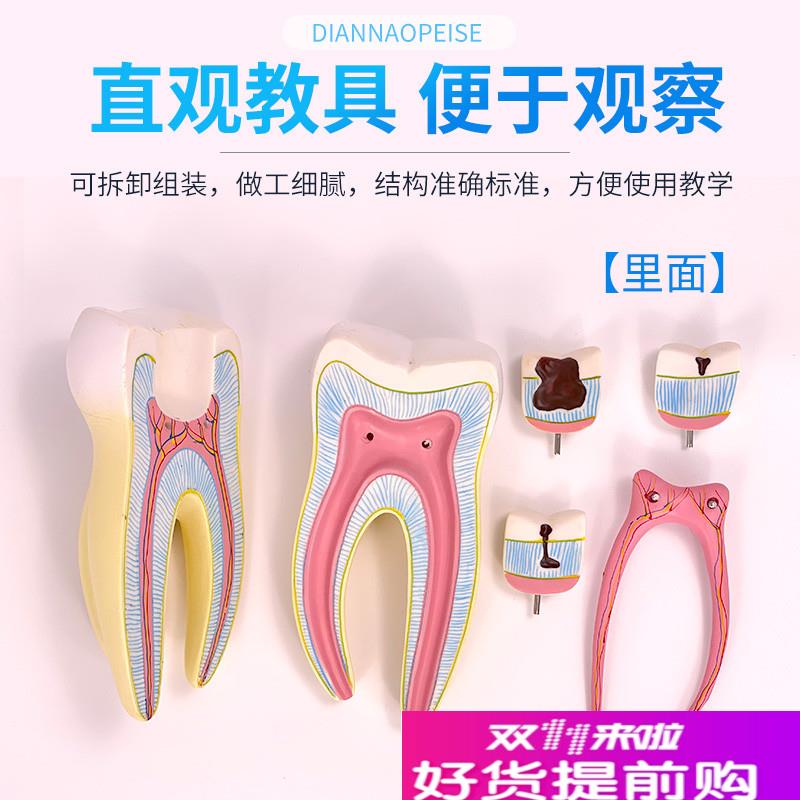 臼牙磨牙牙齿模型人体解剖放大牙E齿模具儿童牙齿玩具教具模型