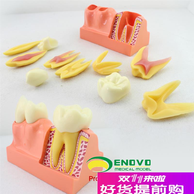 颐诺正品牙体分解模型牙齿解剖模型口P腔科教学牙齿模型