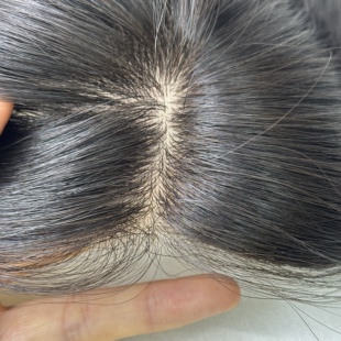 梧桐雨亲肤无痕假发片生物膜双递针补发片透气遮白发增发量纯手工