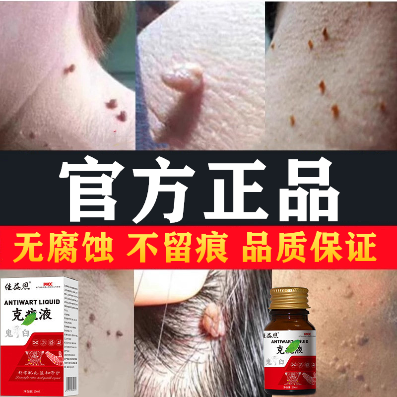 脱欣鬼臼素毒素酊软膏尖锐男女重组人干扰复方竹叶草脂